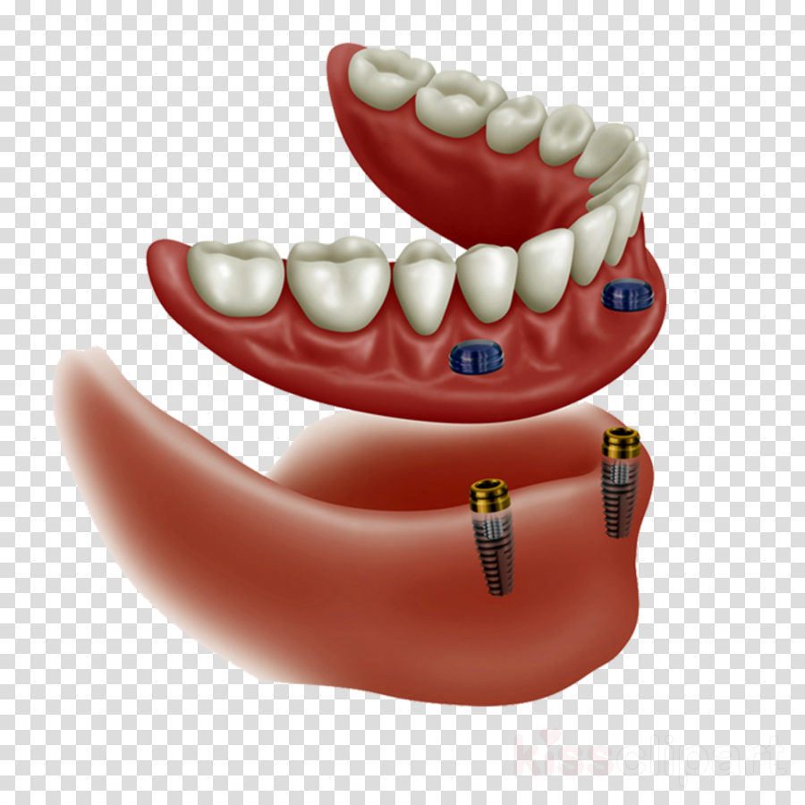 free clipart,transparent png image,clip art,Dentistry, Tooth, Mouth